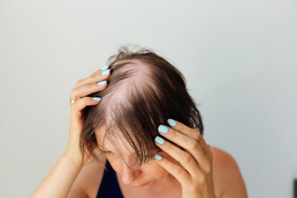 lutter contre la chute des cheveux 