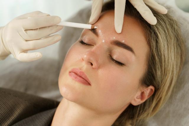 Comment combler les sillons nasogéniens : injections ou autres techniques adaptées ?