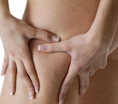 Traitement des varices aux jambes à Boulogne-Billancourt Traitement des varices aux jambes à Boulogne-Billancourt